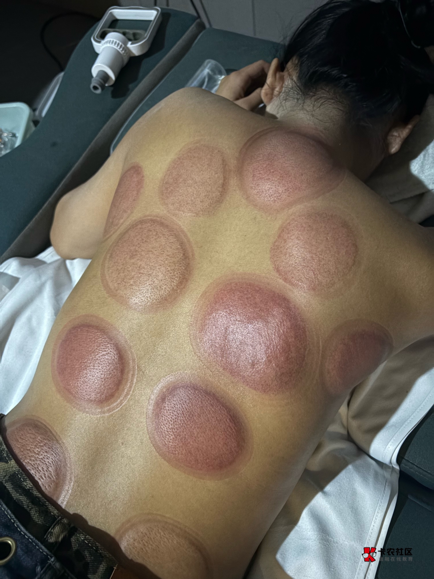 老狗们入职男技丝一个月了我这拔罐技术怎么样

59 / 作者:哦这样吗 / 